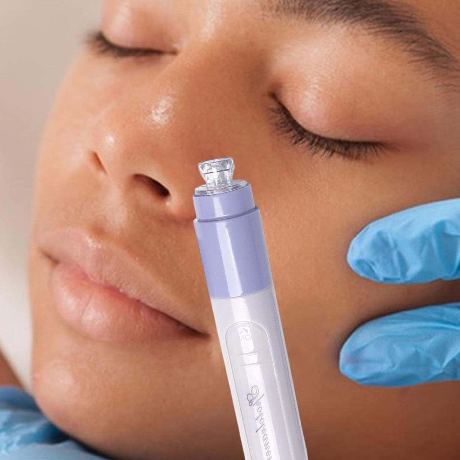 Electric Black Head Remover Extractor Tool